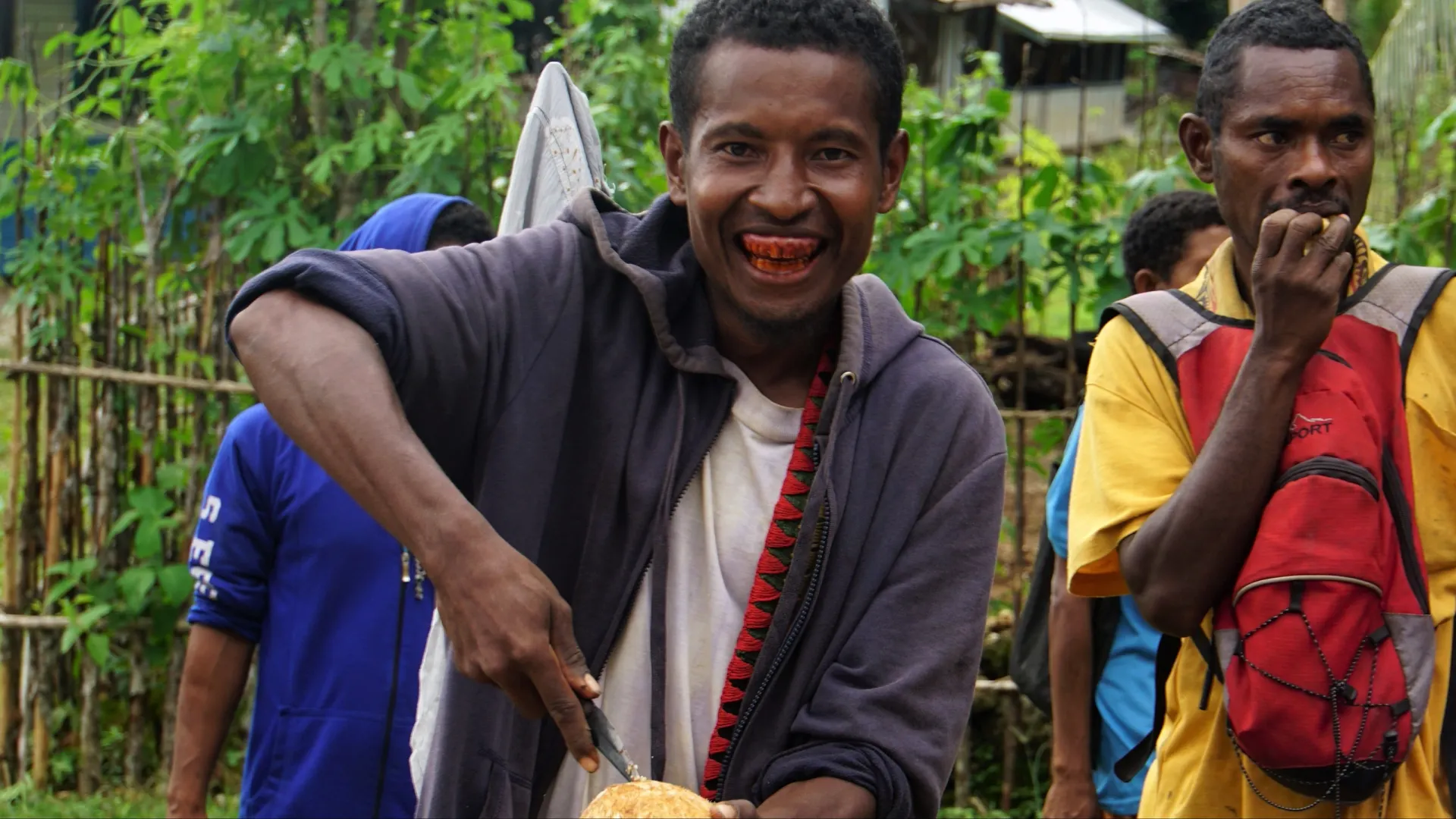 Молодой человек из Папуа — Новой Гвинеи, постоянно жующий бетель, что заметно по состоянию его зубов и десен. Фото: Annalucia/Shutterstock/Fotodom