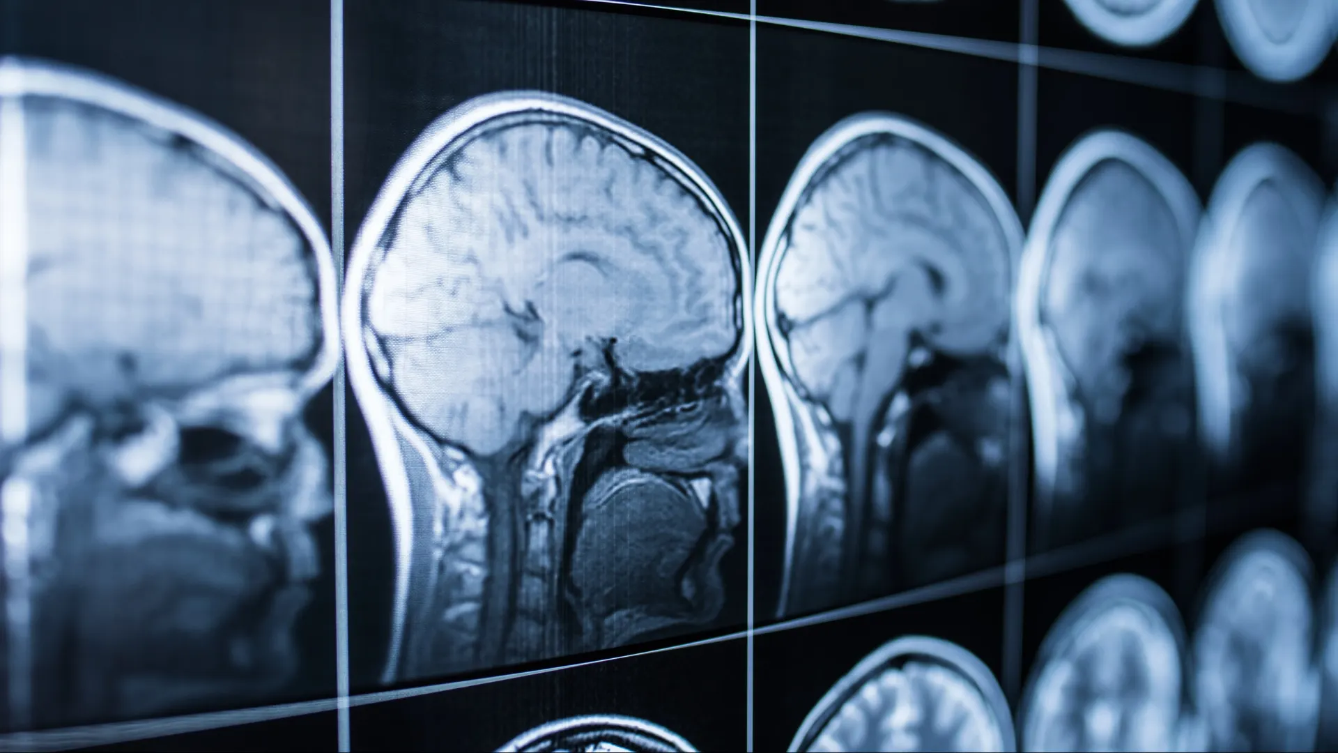 Фото: Jalisko/Shutterstock/Fotodom