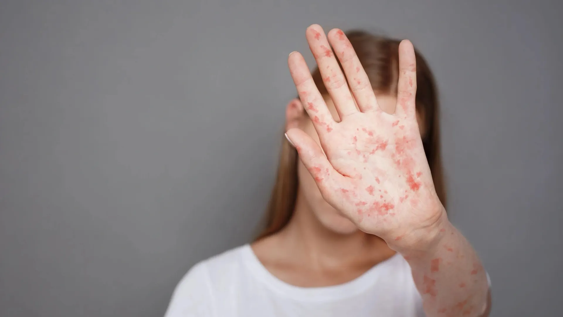 Фото: Prostock-studio/Shutterstock/Fotodom