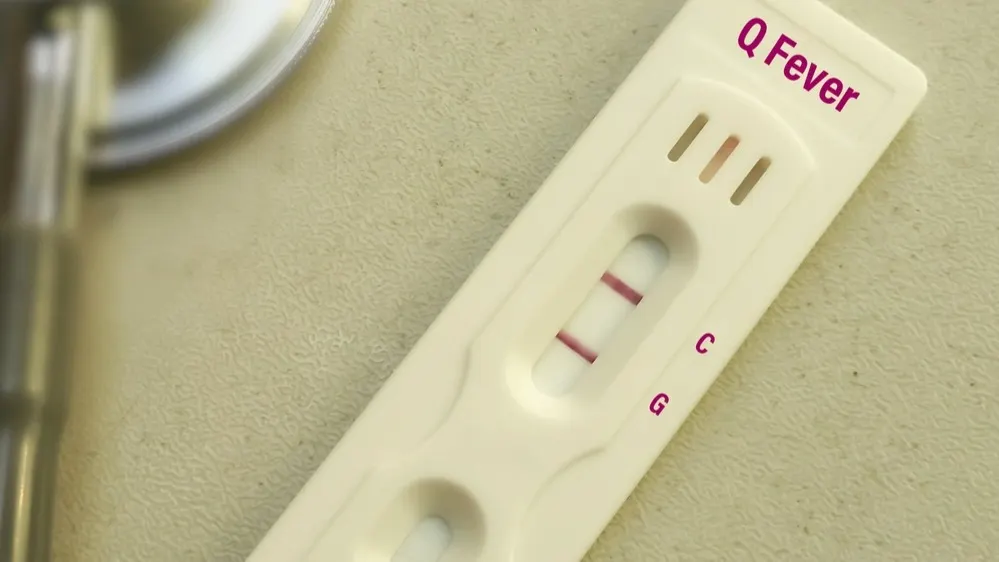 Анализ крови на лихорадку Ку. Фото: Babul Hosen/Shutterstock/Fotodom