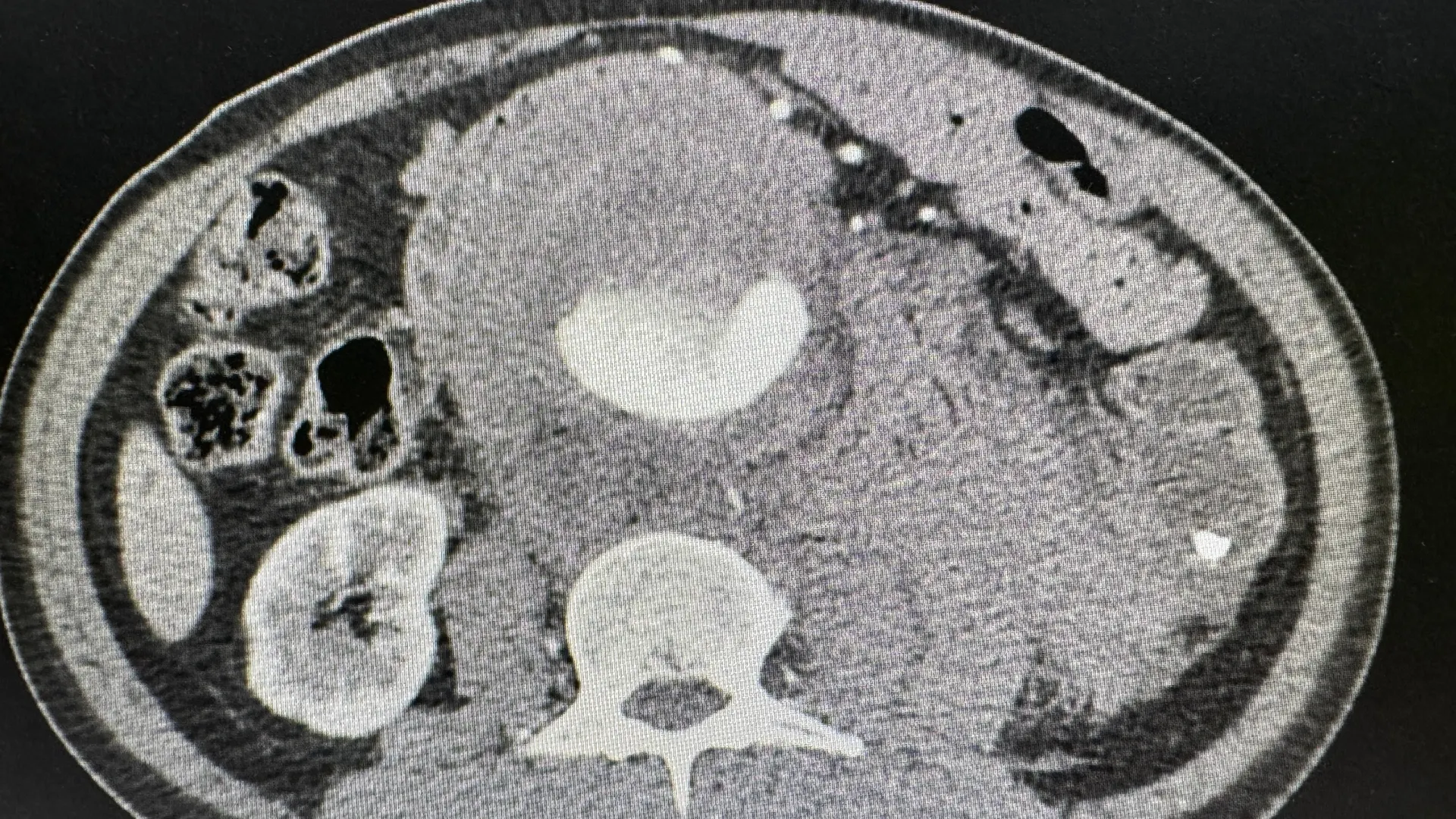 Фото: yupapan samlee/Shutterstock/Fotodom