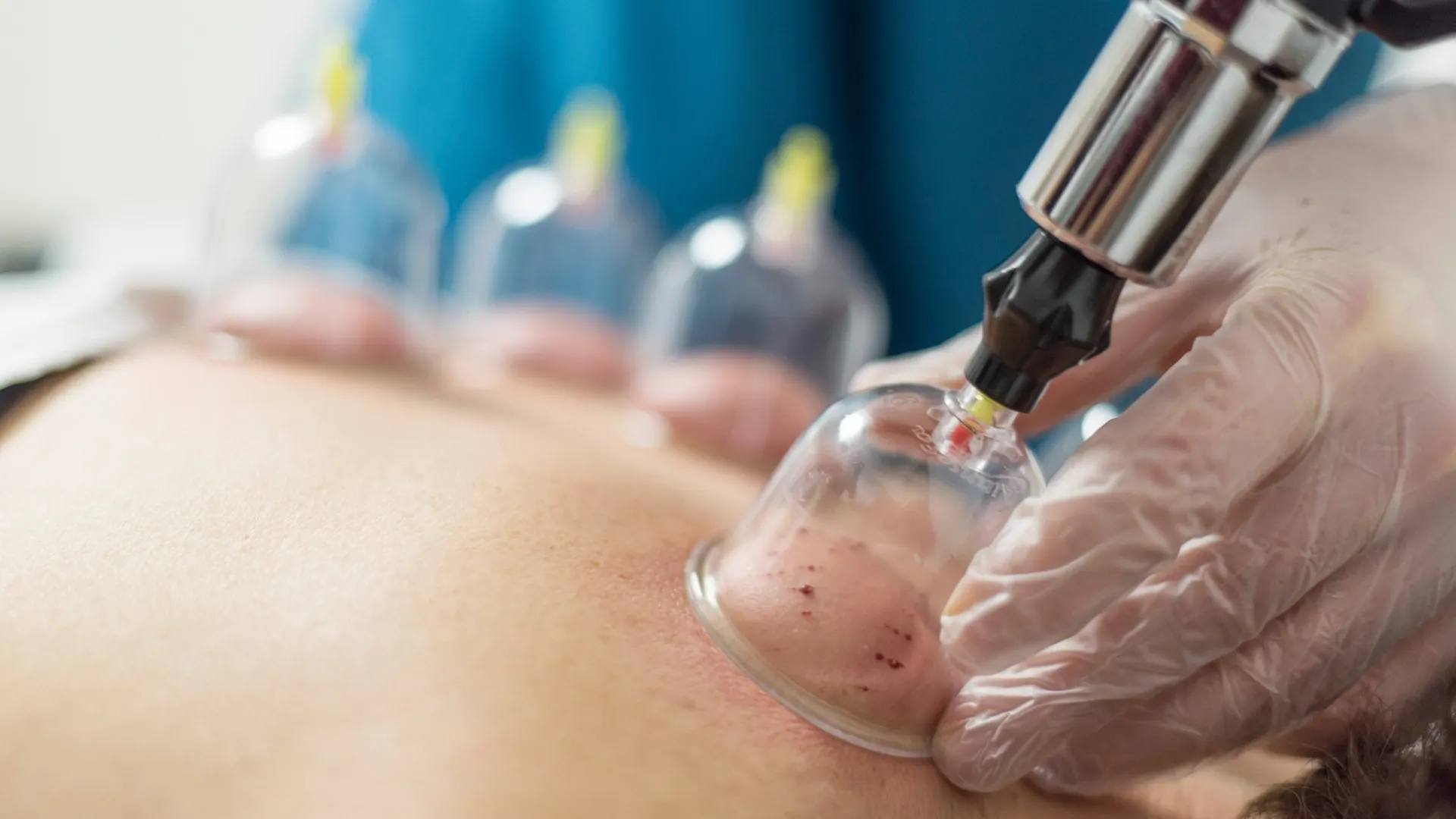 Фото: cinarlarinenes/Shutterstock/Fotodom