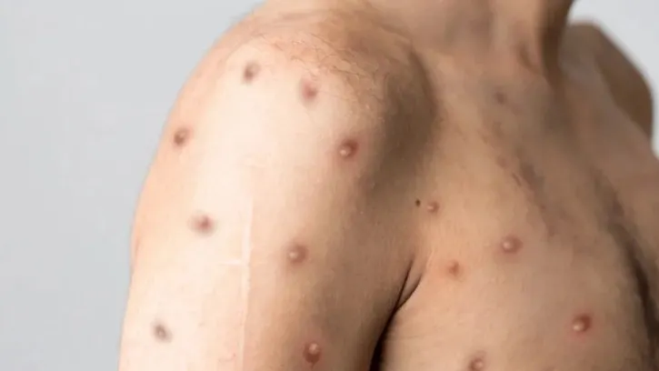 Источник фото: Berkay Ataseven / Shutterstock.com