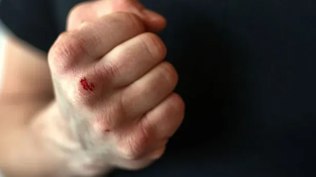 Футболиста из Израиля дисквалифицировали на 99 лет за избиение соперника